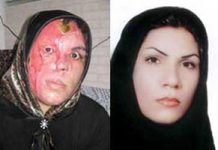 Iran: Säureangriffe gehen weiter, eine 24 Jahre alte Frau war auch das Ziel