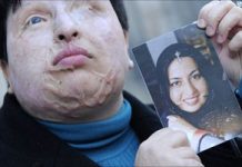 Maryam Rajavi verurteilt die Welle von Säureangriffen gegen iranische Frauen