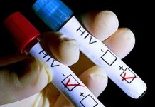 Das tödliche iranische HIV Problem