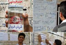 Poor Iranians Selling Their Body Parts