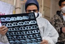 Coronavirus Pandemie: Unterschiede zwischen dem Iran und anderen Ländern